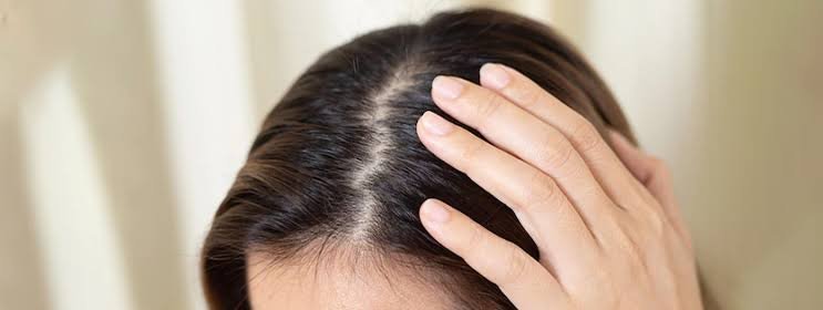 Normal scalp 