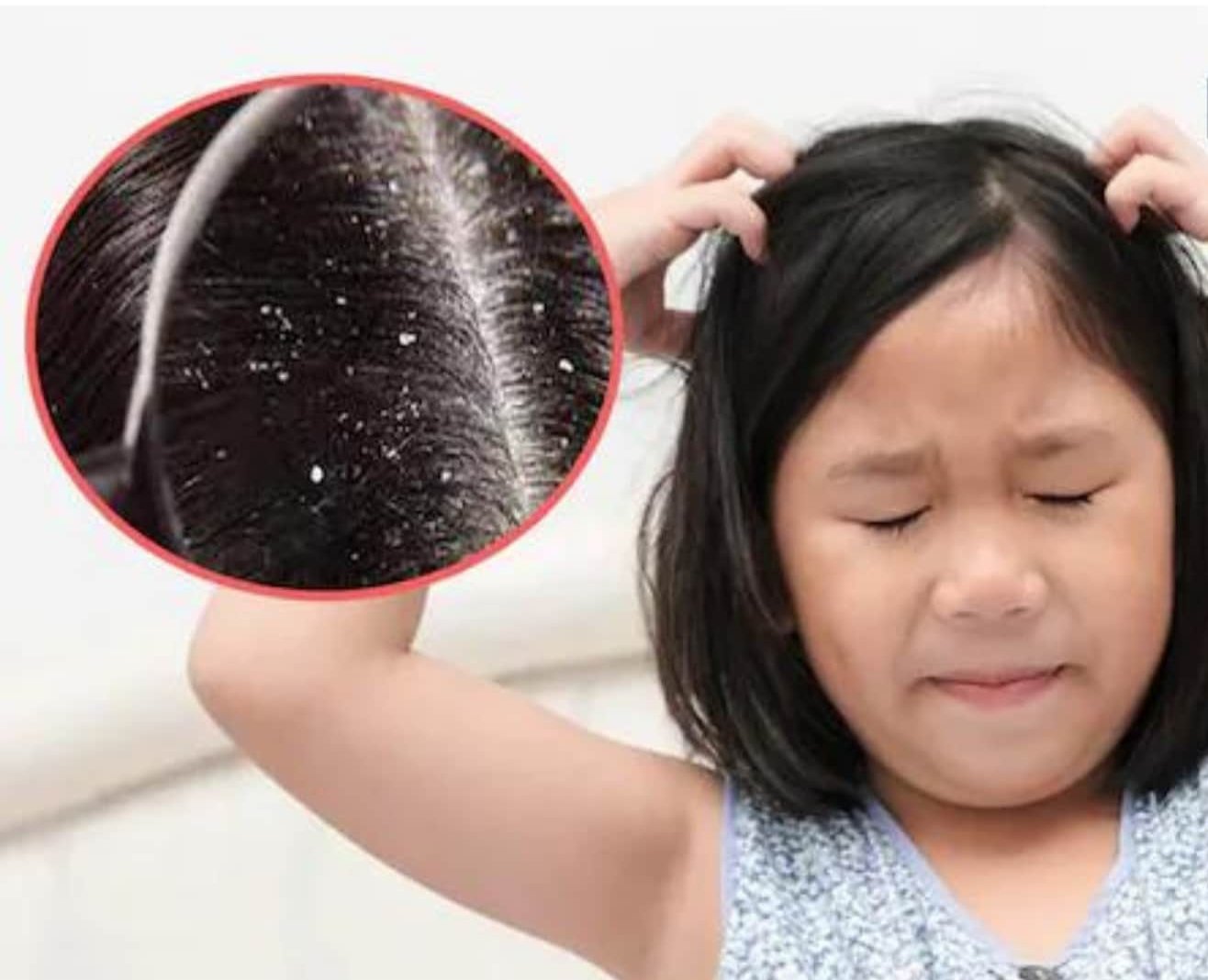 Haircut routine for dry scalp kids 